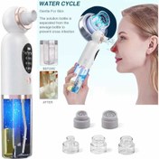 میکرودرم مخزن دار صورت برند (موهایر )